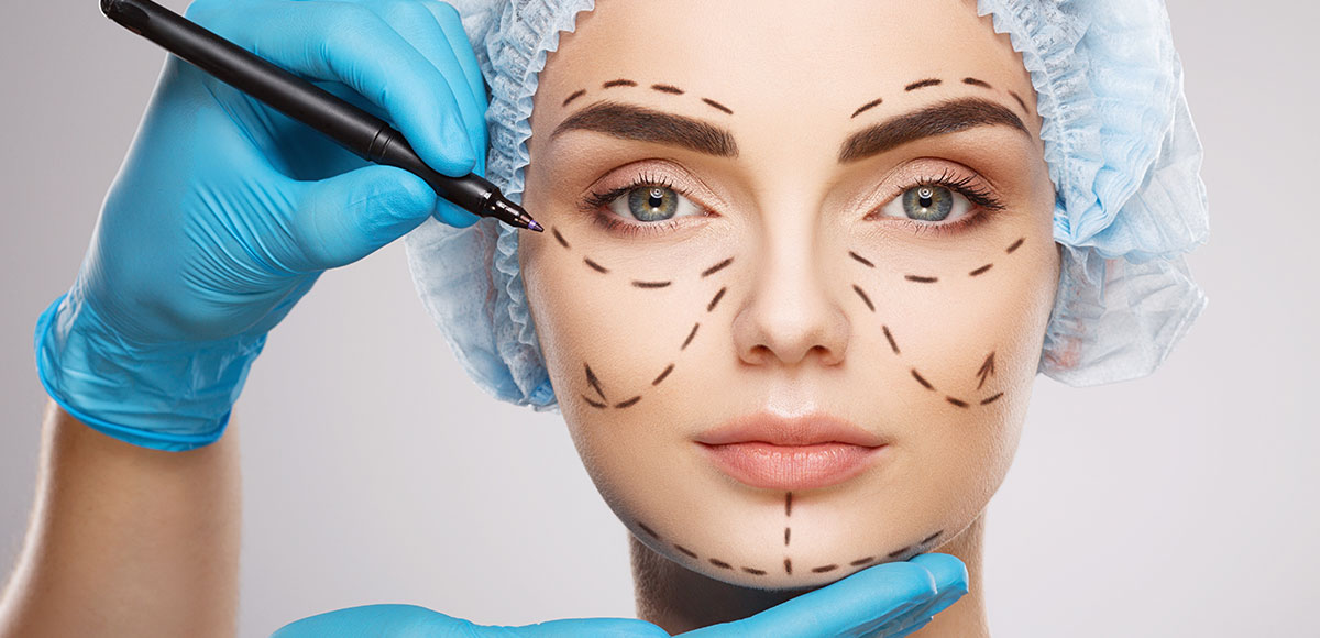 Mulher com rosto desenhado para o procedimento cirúrgico para a plástica 